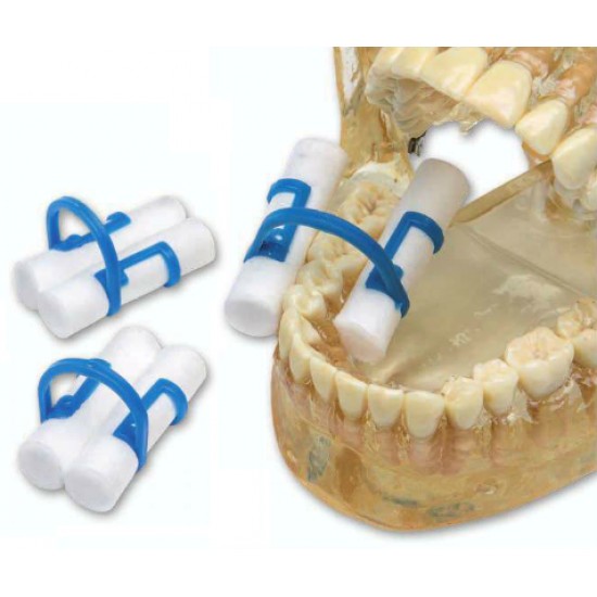 ΠΛΑΣΤΙΚΑ ΣΥΓΚΡΑΤΗΤΙΚΑ ΤΟΛΥΠΙΩΝ